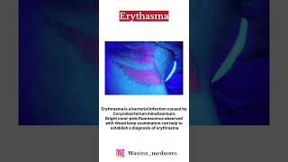 📌 Erythrasma 📌 PYQ 💯🔥 shorts youtube viralvideo [upl. by Turpin]