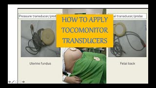 How to apply tocomonitor transducers [upl. by Porter250]