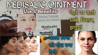 Medisalic Cream Review  Clobetasol Propionate Salicylic Acid Ointment  use and Benefits [upl. by Ykcor]