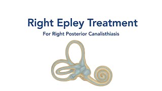 At Home Right Epley Maneuver for BPPV Vertigo [upl. by Ardnnaed]