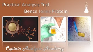 E14 Bence Jones Protein من تحليل البول اقدر اعرف نوع السرطان اذاى اشتغل هذا البروتين بالمعمل [upl. by Kentiga]