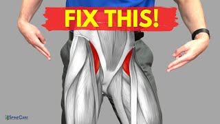 How to Relieve Hip Flexor Pain in 30 SECONDS [upl. by Bowra]