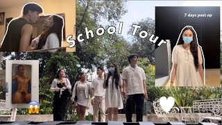 SCHOOL TOUR 2023 7 days post op  Mary Lite Lamayo [upl. by Aimehs]