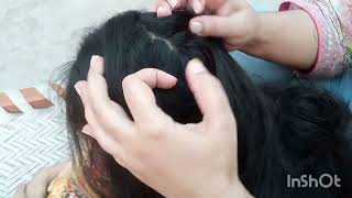 ASMR lice picking  lice picking ASMR lice liceremoval licerelaxingvideo licepicking [upl. by Innig]