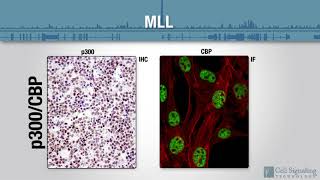 Epigenetic Drivers of Leukemias [upl. by Aniretak]