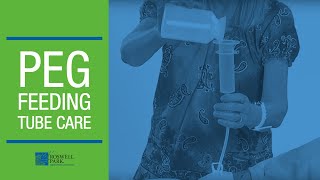 PEG Feeding Tube Care Instructions  Roswell Park Patient Education [upl. by Ayocat432]