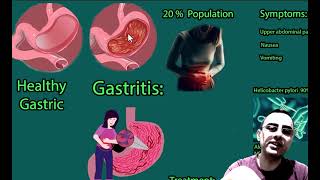 Understanding Gastritis Causes Symptoms and Treatments [upl. by Faxon]