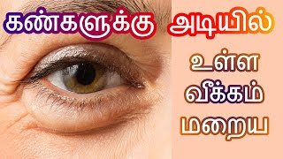 கண்களுக்கு அடியில் உள்ள வீக்கத்தை போக்க  How to cure puffy eyeseye bags in tamilkaruvalayam poga [upl. by Schapira667]