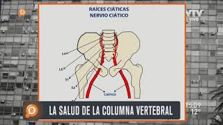 ¿Qué es la ciática o ciatalgia  Dr Isaac Jakter [upl. by Mintun]