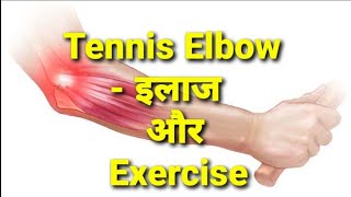 Tennis Elbow Treatment इलाज amp Exercisestretchesphysiotherapy [upl. by Eiddal]