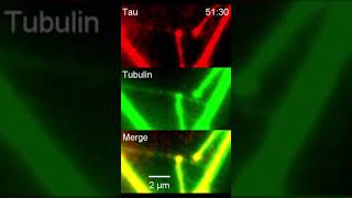 Microtubule weaving by tau droplets [upl. by Charley]