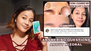 HOW TO APPLY NIZORAL ON FUNGAL ACNE FULL DETAILS  Ms Krisha Natividad [upl. by Hasen]