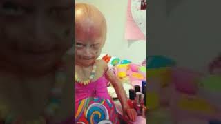 Adalia rose is ugly [upl. by Bravin930]