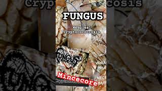 mincecore FUNGUS  MENGIEAL CRYPTOCOCCOSIS mincecore mincecore grindcore crustpunk fungus [upl. by Haugen]