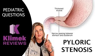 PYLORIC STENOSIS  questions with Dr Sharon [upl. by Gnoht]