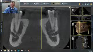 CBCT scan review by Dr Aneszko at WTDC Chicago [upl. by Haskel]