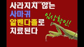 구충재 알벤다졸로 사마귀 치료 임상실험 완료 [upl. by Airetak]