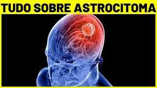 ASTROCITOMA  O que é TIPOS CAUSAS SINTOMAS E TRATAMENTO  Tumor cerebral [upl. by Eirrod150]