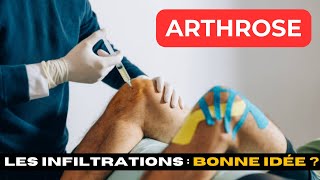 ARTHROSE  Les injections et infiltrations estce une bonne idée [upl. by Robillard]