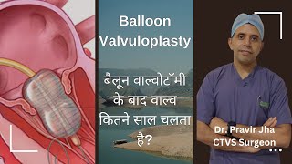 BMVबिना चीरफाड़ Balloon से वाल्व खोलना  Balloon Mitral ValvuloplastyValvotomy  Dr Pravir Jha [upl. by Sela989]