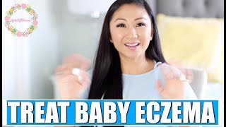 3 WAYS TO TREAT BABY ECZEMA It really works [upl. by Beaumont970]