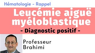 Leucémie Aiguë Myéloblastique Diagnostic positif [upl. by Draude249]