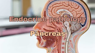 Endocrine pathology lecture Pancreas [upl. by Gambell56]