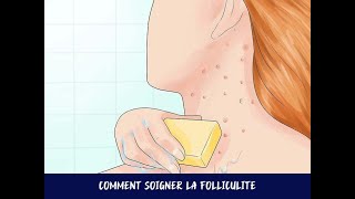 Comment soigner la folliculite [upl. by Flavian]