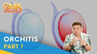 Orchitis What Is It Causes Symptoms and Treatment Part 1  Usapang Pangkalusugan [upl. by Aevin915]