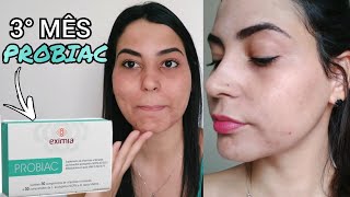 RESENHA PROBIAC EXIMIA 3° MÊS  ACNE HORMONAL  CRIS MARIA [upl. by Jaquelyn]