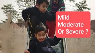 Understanding The Three Levels Of Autism  Mild Moderate Or Severe [upl. by Palm]