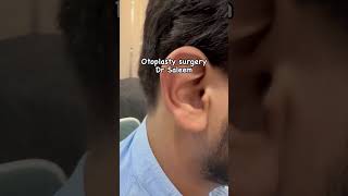 Otoplasty surgery for ear reshaping amp prominent ears otoplasty otoplastysurgery [upl. by Bealle]