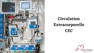 Questce que la Machine Circulation Extracorporelle  CEC [upl. by Ear]