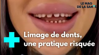 “Dents de requin” la tendance des influenceurs qui inquiète les médecins  Le Magazine de la Santé [upl. by Adnek559]