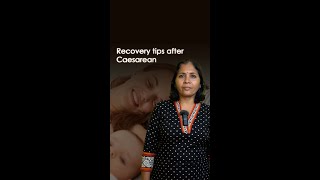 How to recover after a cesarean 🤱 [upl. by Ecnadnac]