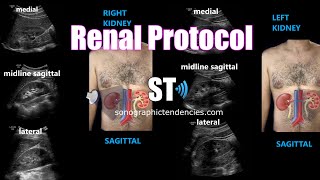 Renal Ultrasound Protocol [upl. by Dolf]