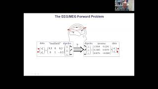 The EEGMEG forward model [upl. by Gehlbach720]