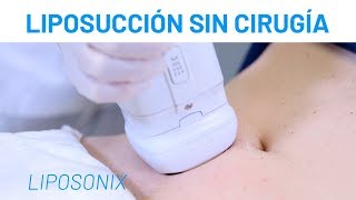 Liposucción SIN Cirugía Masculina Liposonix  Gustavo Egusquiza [upl. by Lear]