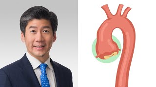 Surgeon QampA What Are Annual Growth Rates for Aortic Aneurysms [upl. by Yelehsa845]