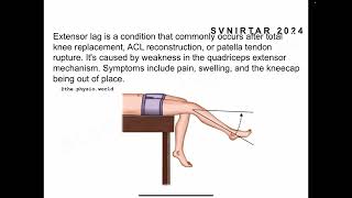 SVNIRTAR MPT Entrance 2024 QUESTION NUMBER14 answer with concept [upl. by Olinde]