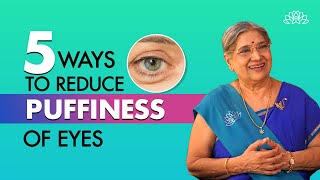 Home Remedies for Puffy Eyes I Treat puffy eyes naturally I Dr Hansaji [upl. by Nyrret]