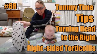 6R Tummy Time Head Control TipsTurning Head Right for RightSided Torticollis Treatment in Babies [upl. by Freddy568]