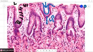 Stomach Histology Slide  Understanding Stomach Mucosa Med Madness [upl. by Naehs]