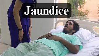 Jaundice  Standardized Clinical Examination Videos  KYAMC [upl. by Ainahpets]