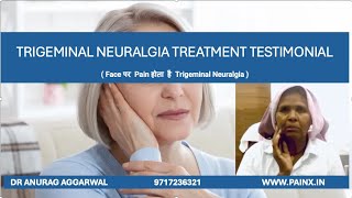 Trigeminal Neuralgia treatment  facialpain  चेहरे की नसो मे दर्द I Neurolysis I RFA [upl. by Aiva594]