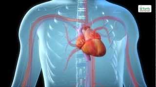 Angioplasty Procedure Animation Video [upl. by Caylor856]