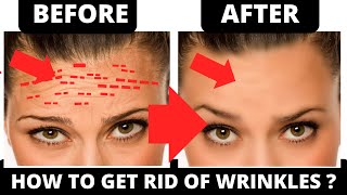 FOREHEAD LINES REMOVAL EXERCISE  HOW TO GET RID OF WRINKLES ON FOREHEAD   REMOVE WRINKLES [upl. by Adnohsad]