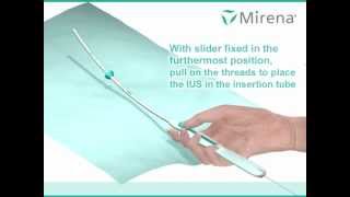 Mirena IUS insertion procedure animated [upl. by Rojas]