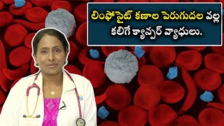 Cancerous Diseases Growth Of Lymphocyte Cells  లింఫోసైట్ కణాల పెరుగుదల వల్ల క్యాన్సర్ వ్యాధులు [upl. by Akema]