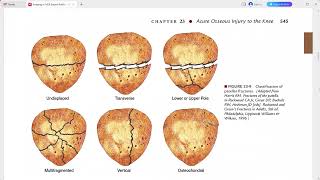 RADIOLOGY EXAM CASES [upl. by Ehling]